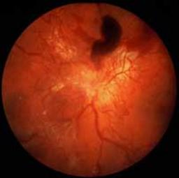 THE LATEST DIGITAL IMAGING TECHNOLOGY hi tech eye exam digital imaging