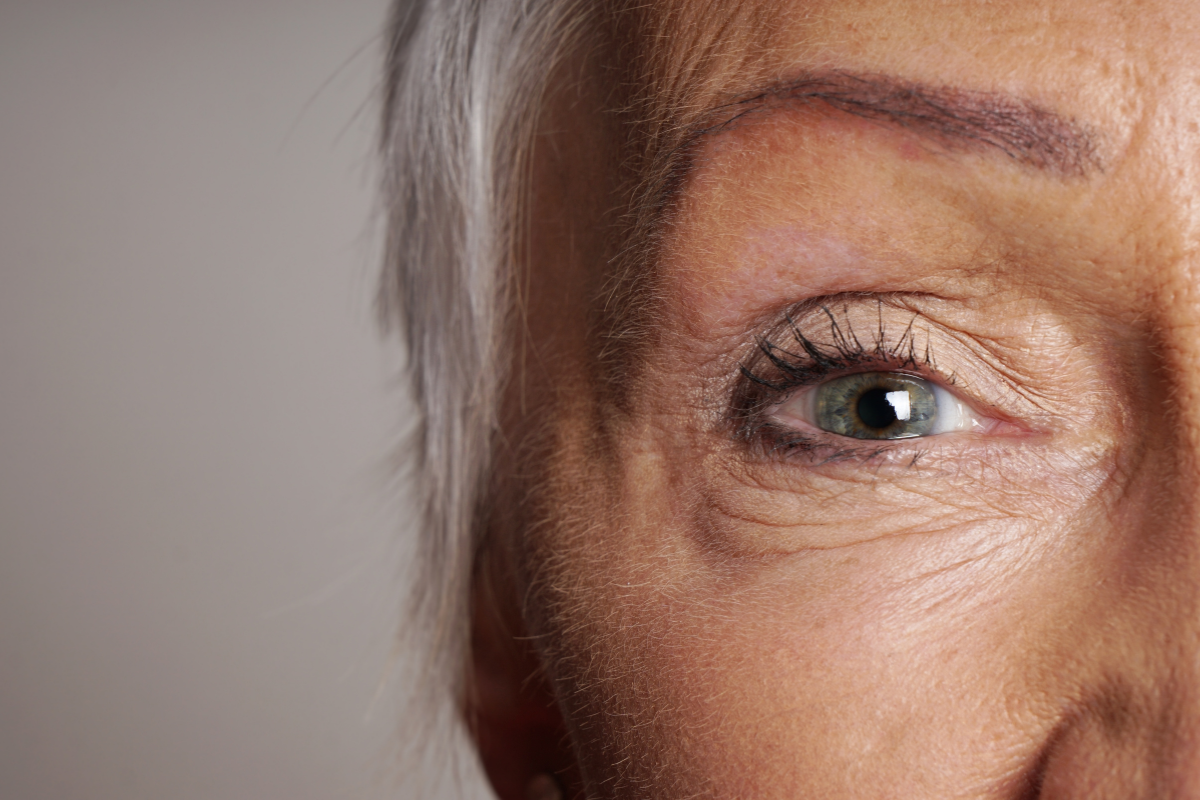 Aging eye